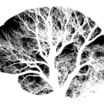 What is dementia with Lewy bodies?